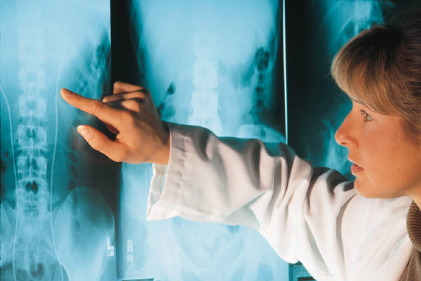 Do You Need An X-Ray To Diagnose Your Back Pain?