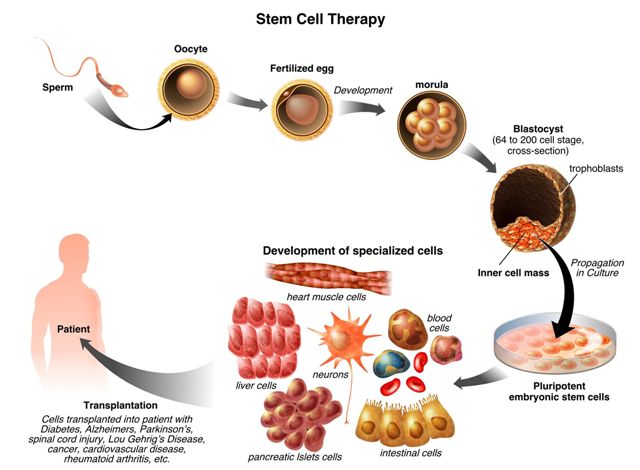 Learn More About Stem Cell Treatment