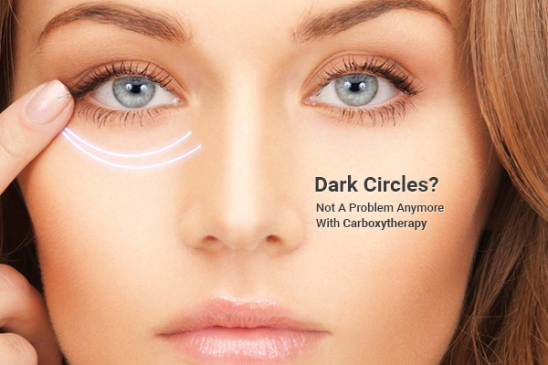 Dark Circles Is No More A Big Problem With Carboxytherapy