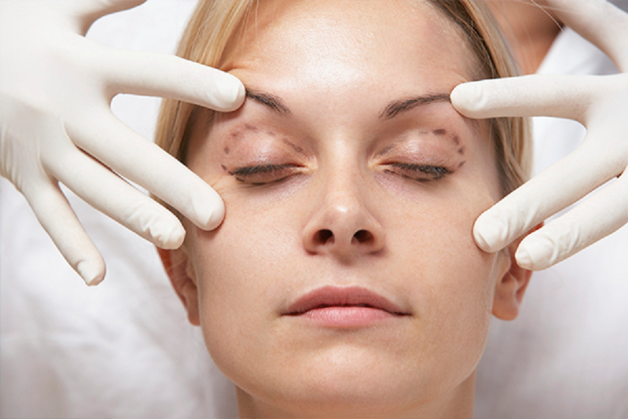 9 Ways To Have A Successful Recovery after Eyelid Surgery